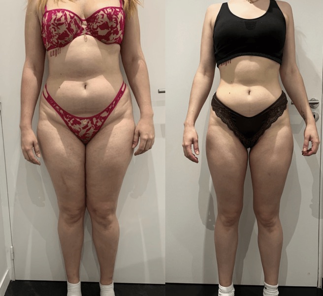 Objectif ventre